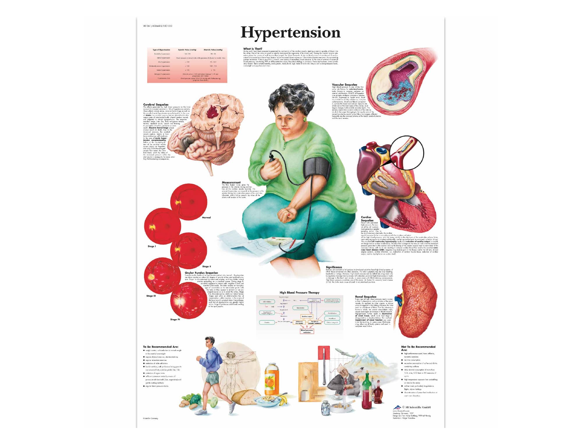 L’hypertension